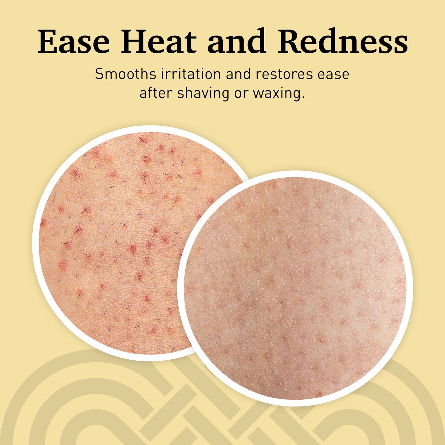 The Rescue Gel Serum (Hypochlorous Acid)