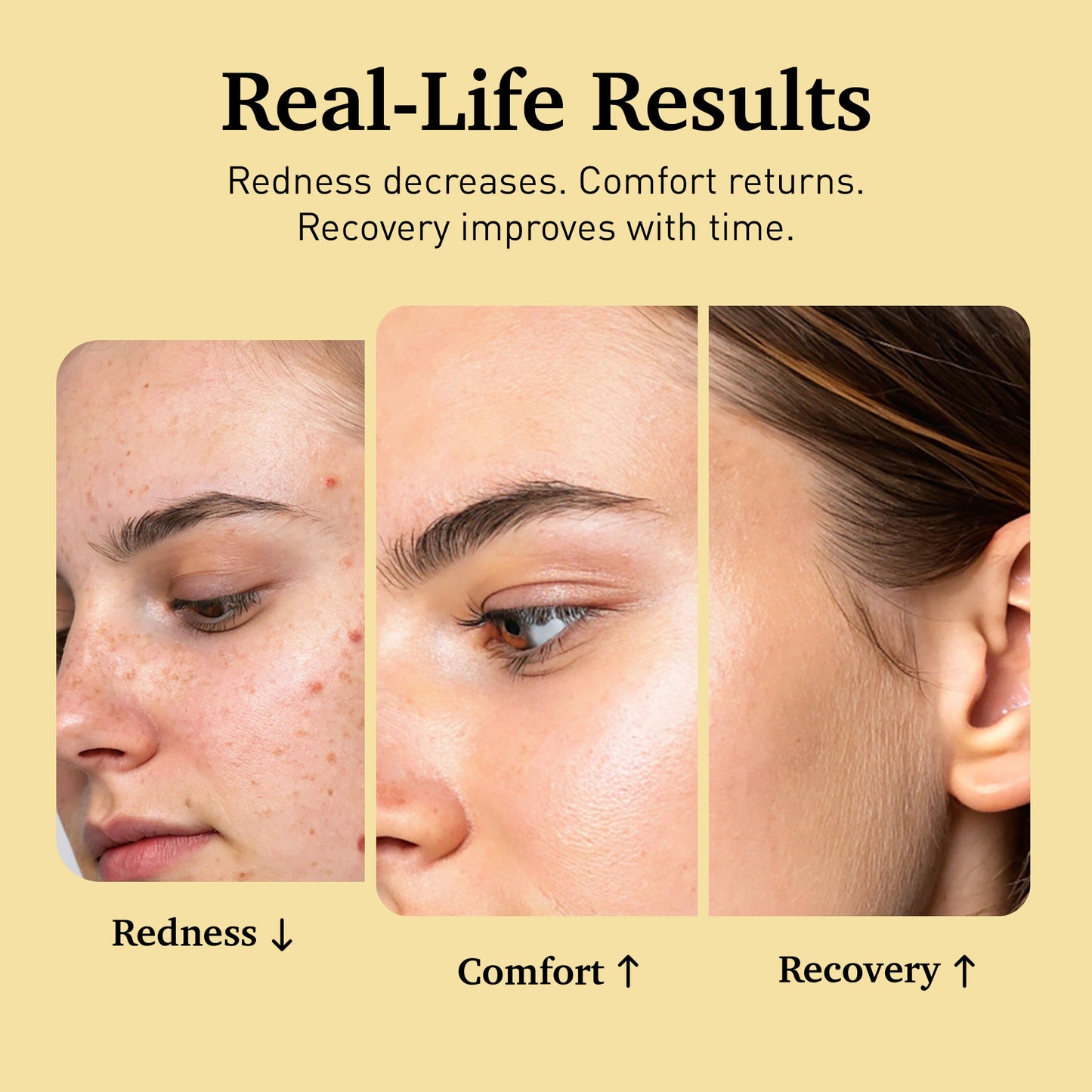 The Rescue Gel Serum (Hypochlorous Acid)