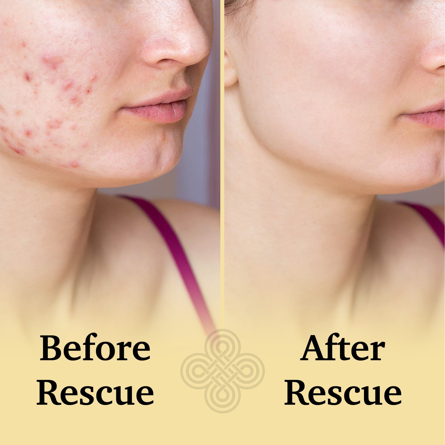 The Rescue Spray