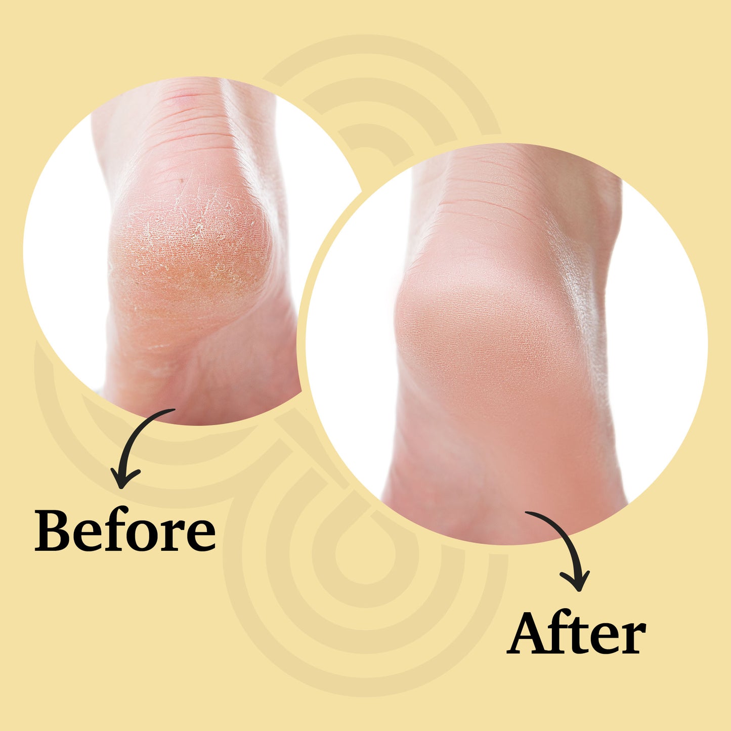 The Melting Balm: Tallow + Rosehip Oil